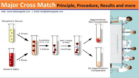 blood compatibility test with a drop of blood|Pretransfusion Testing .